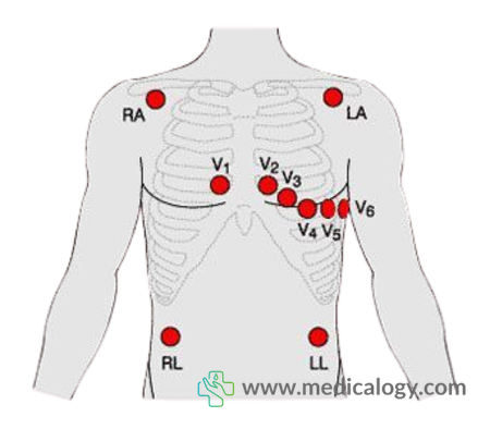 beli 12-Lead ECG ( 12-Lead ECG Board+12-Lead ECG (Cable)