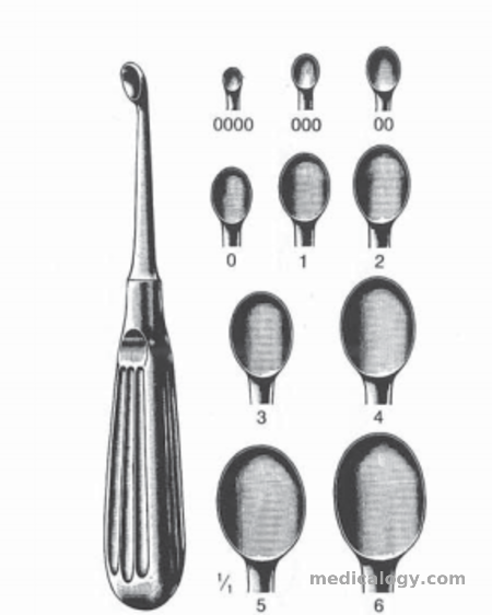 harga Dimeda Orthopedic Set VOLKMANN Bone Curette Fig.00