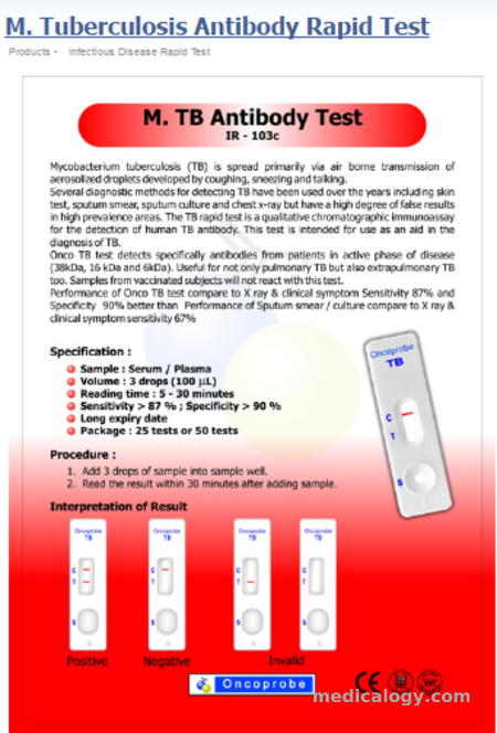 jual Oncoprobe Rapid Test Tuberculosis Antibody 50 Card/Box