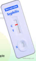 jual Oncoprobe Rapid Test Syphillis 50 Card/Box