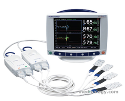 jual Pulse Oximeter Invos Cerebral Somatic